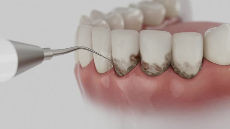 Reliable Dental Implants contractor in Becker, MN by Smile Center Dentistry